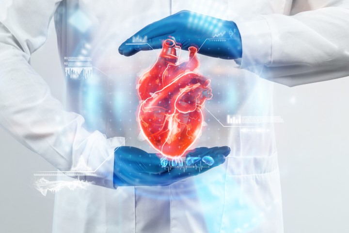 Excess risk of cardiovascular disease and mortality after amputation in type 2 diabetes: a nationwide population study from the Swedish National Diabetes Register